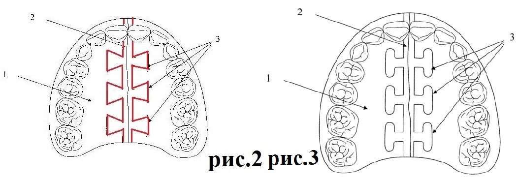 1-b