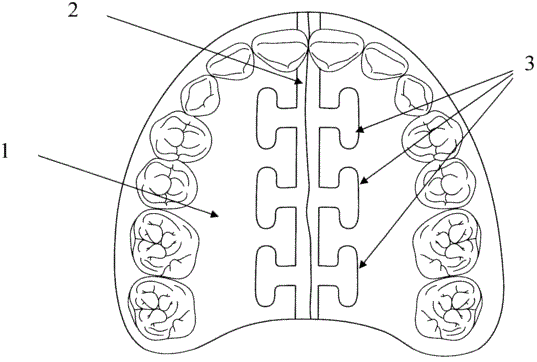 1-m