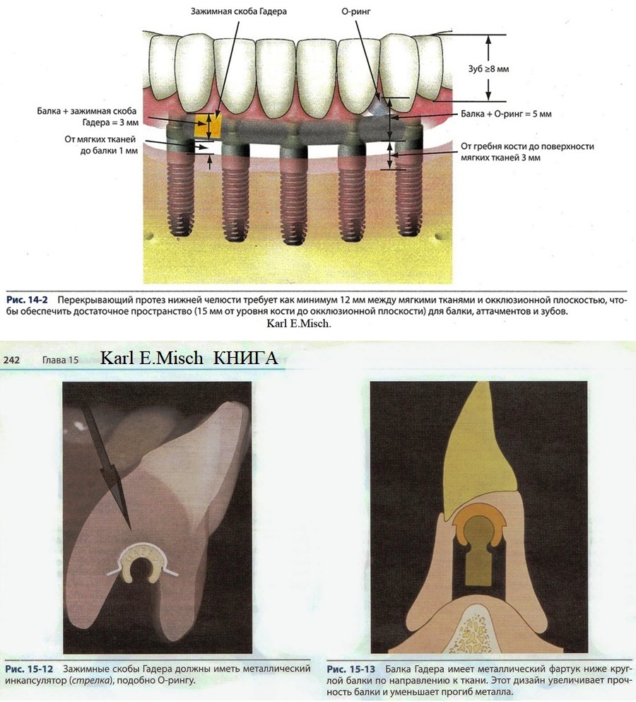 721
