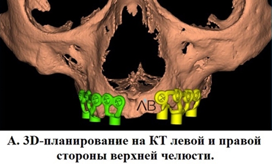 760