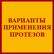 J21.png