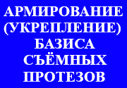 Y.png